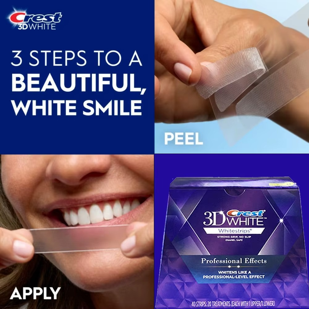 Crest 3D Whitestrips Luxe — Professional Teeth Whitening